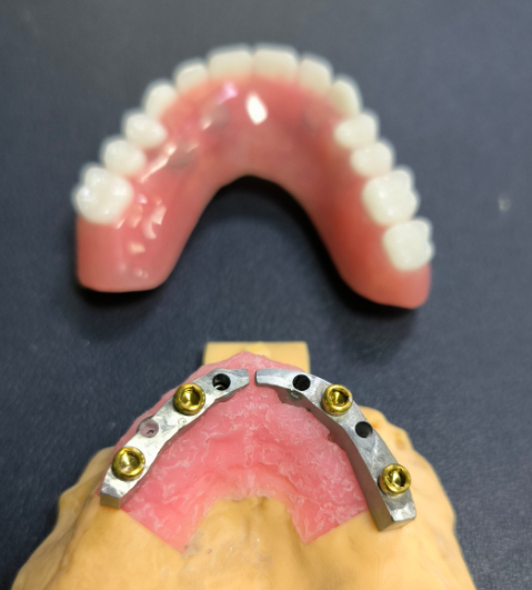 Locator και Titanium Dental Bar