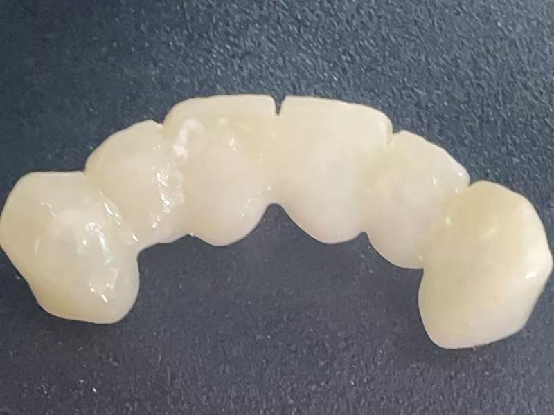 Τι είναι το «Προσωρινό Στέμμα»; Γιατί Χρειάζεστε Ένα;