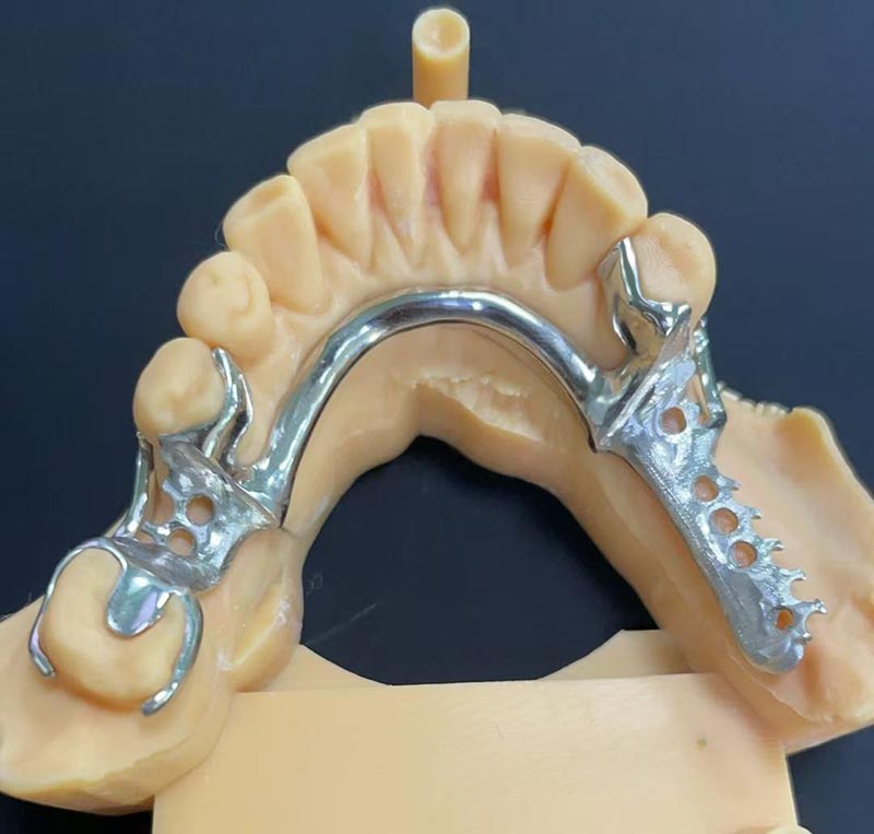 Πλεονεκτήματα του πλαισίου Cobalt-Chromium (Πλαίσιο Co Cr)