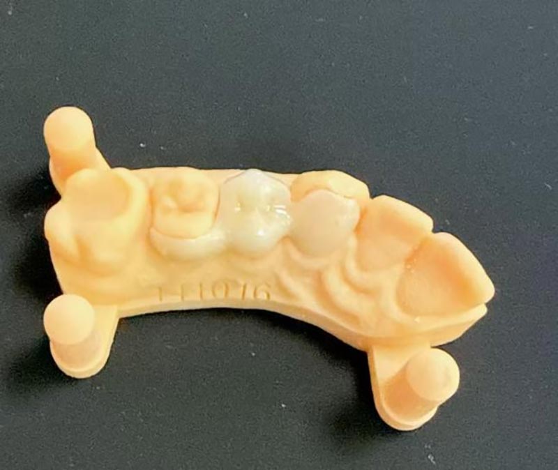 Τι πρέπει να ξέρετε για τις γέφυρες Maryland;