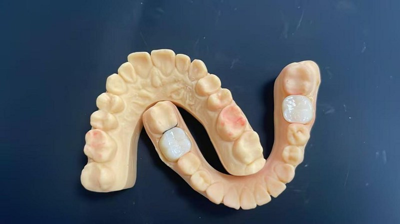 Τι είναι η άκρη του ώμου;