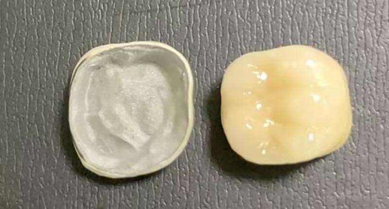 WM DENTAL LAB – Ένα κορυφαίο κινέζικο οδοντιατρικό εργαστήριο