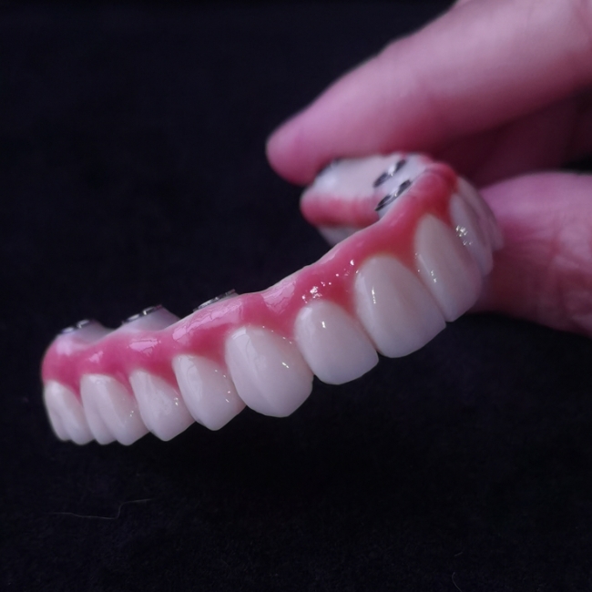 All On X Hybrid Bridge - Full Zirconia Bridge over Tibases