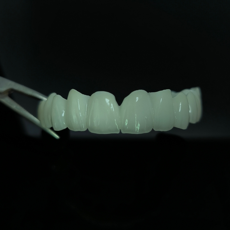 Υψηλή ημιδιαφανή γέφυρα Zirconia Layered Zirconia China Dental εργαστήριο