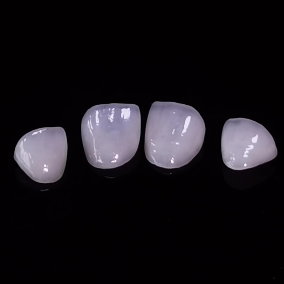 Hight Translucent Dental Veneers Layered Emax Veneer Dental εργαστηριακή εργασία