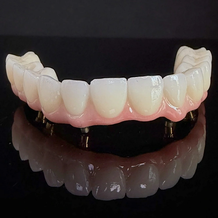 Hybrid Zirconia Over Ti Bar