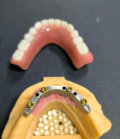 Εντοπιστής και οδοντιατρική μπάρα