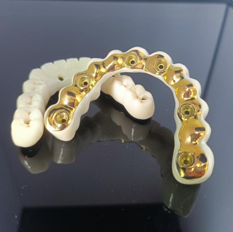 All On X Hybrid Bridge - Full Zirconia Bridge πάνω από Titanium Bar